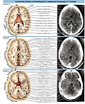 Normal Cerebral Anatomy