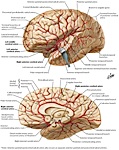 Cerebral Arteries Lateral