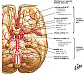 Congenital Cerebral Aneurysms